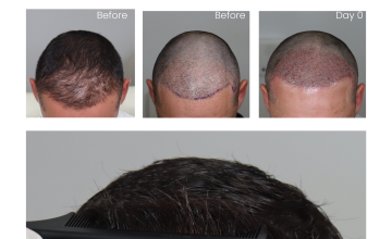 Dr. Espinosa Custodio - Restoration Surgery