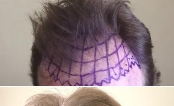 Before and After 